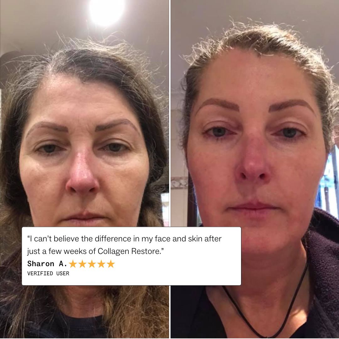 Collagen Restore™ -Stay Healthy