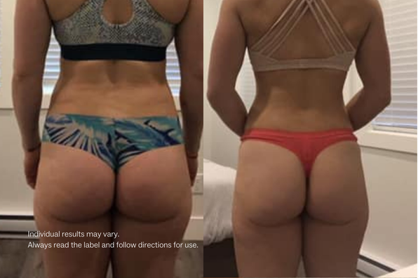 Collagen Restore™ -Stay Healthy