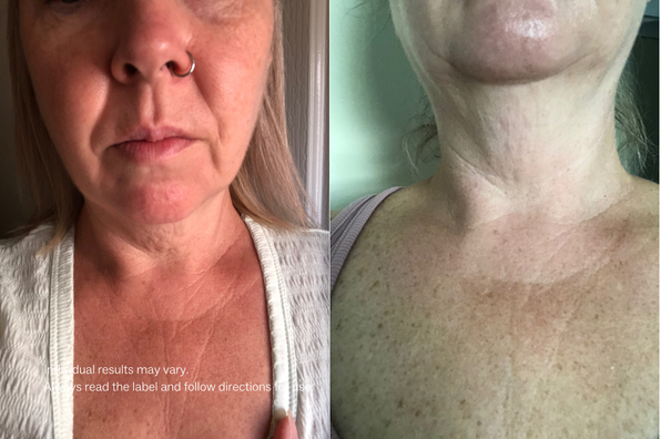 Collagen Restore™ -Stay Healthy