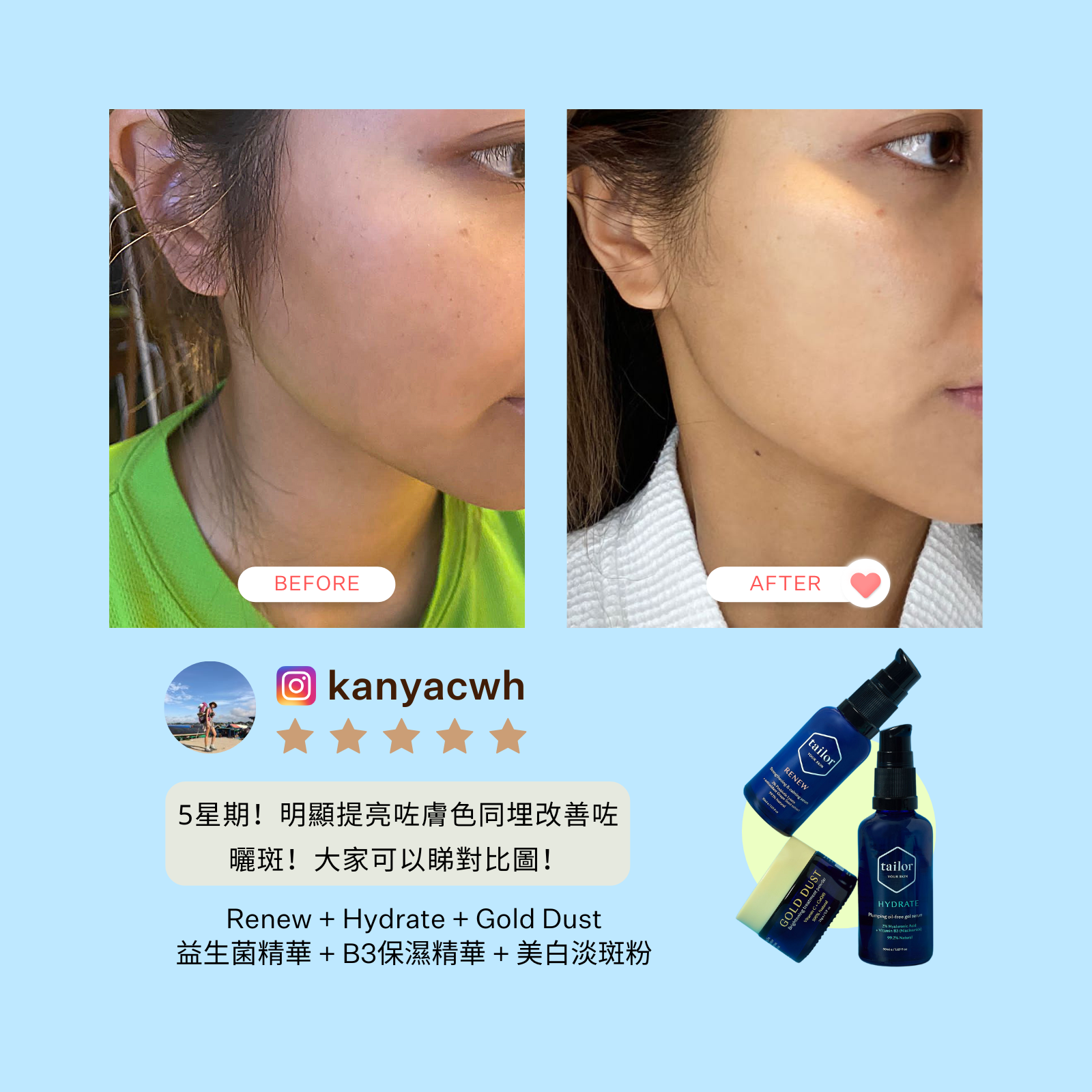 Uneven Skin Essentials